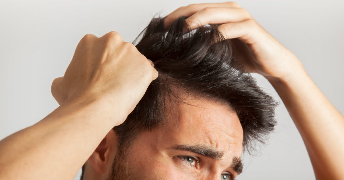 UNDERSTANDING HAIR LOSS IN YOUR 20S: CAUSES AND SOLUTIONS